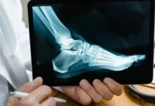 adoption analysis for helpline